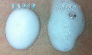 ヒルドイドフォームの泡とヘパリン類似物質外用泡状スプレーの泡の違い